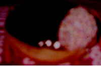 A chocolate jam donut